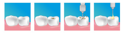 soins dentaires dentiste argenteuil